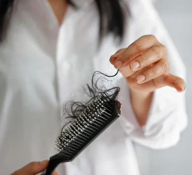 Ayurvedic treatment for Hairloss